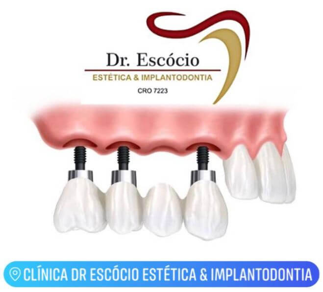 Clínica Dr. Escócio Estética & Implantodontia