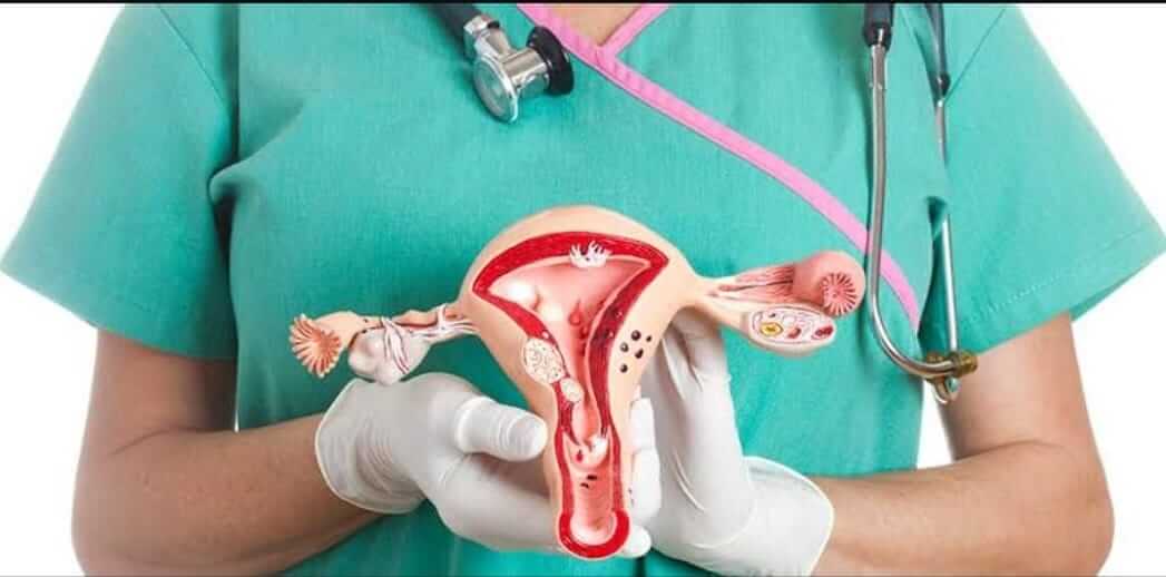 Cisto no ovário é comum e nem sempre traz riscos à mulher - Ginecologista Uberlândia