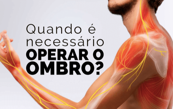 Quando é necessário operar o ombro? Maringá