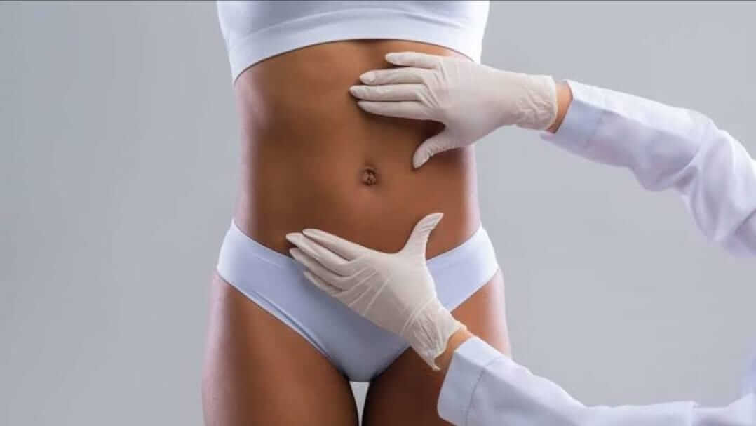 Abdominoplastia: Entenda o procedimento - Abdominoplastia Uberlândia