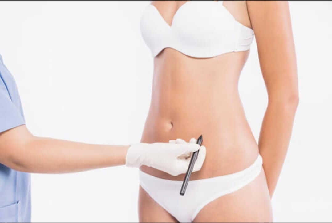 Entenda o procedimento: Abdominoplastia - Abdominoplastia Niterói