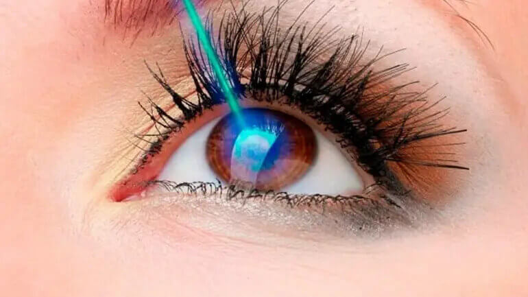 Cirurgia refrativa: procedimento seguro para correção da miopia, do astigmatismo e da hipermetropia - Oftalmologista Linhares
