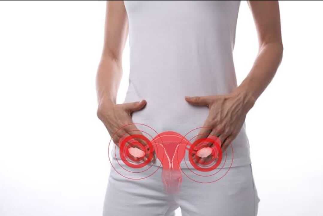 Quais são os sintomas do mioma uterino? - Mioma Uterino Maringá