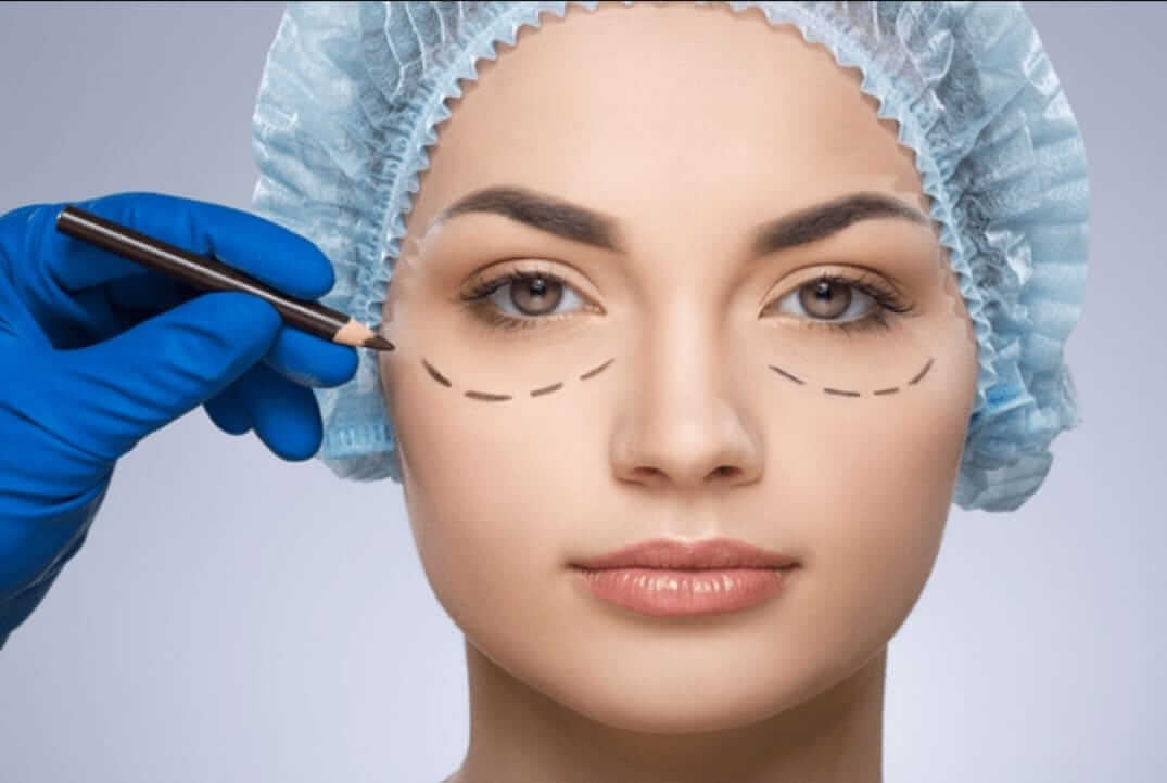 Saiba tudo sobre a blefaroplastia - Blefaroplastia Niterói