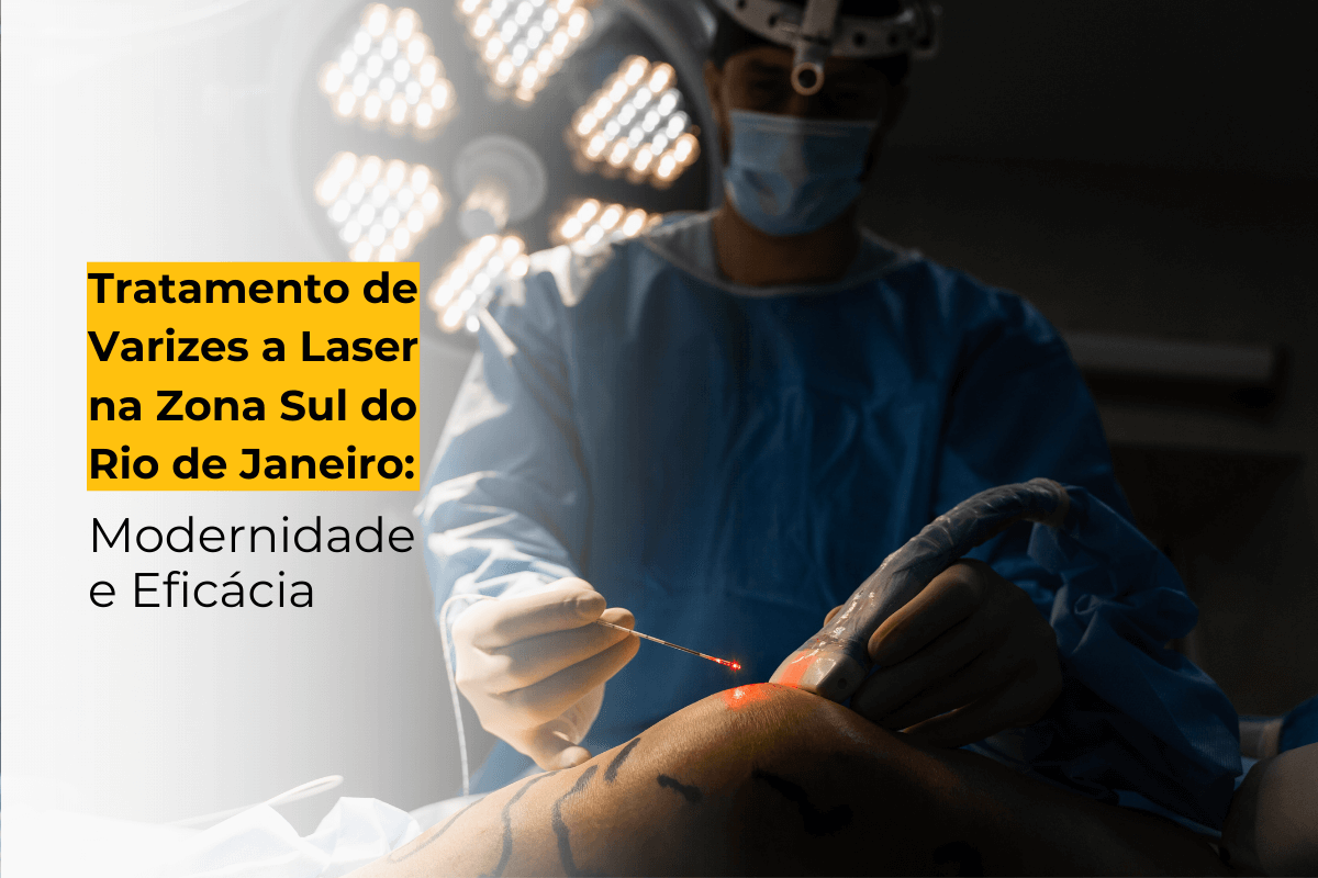 Tratamento de Varizes a Laser em Botafogo: Modernidade e Eficácia