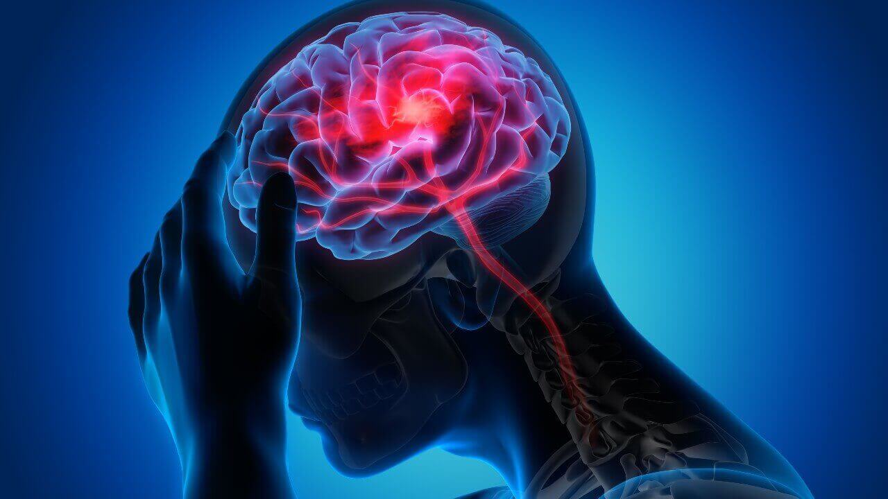 Quais são os primeiros sinais de um tumor no cérebro? - Neurologista Umuarama