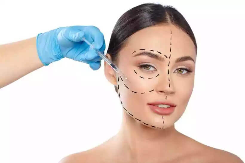 Harmonização facial: onde encontrar um cirurgião plástico para realizar o procedimento?