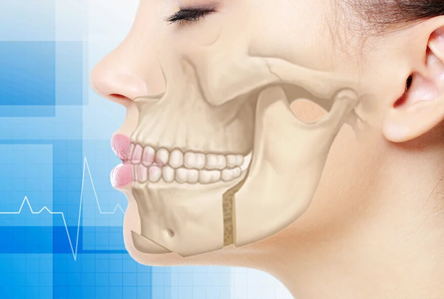 Cirurgia Bucomaxilofacial em Maringá: Tratamentos Modernos e Indicações