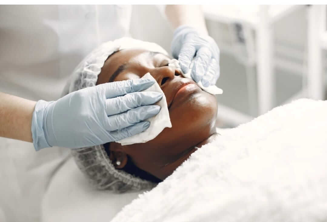 Peeling Químico Joinville: Um dos tratamentos mais efetivos para rejuvenescer a pele