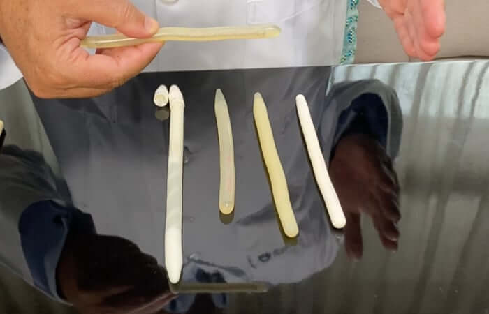 Cirurgia de Prótese Peniana Inflável/Maleável em Curitiba