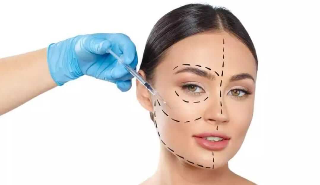 Afinal, o que é harmonização facial? - Harmonização Facial São Paulo