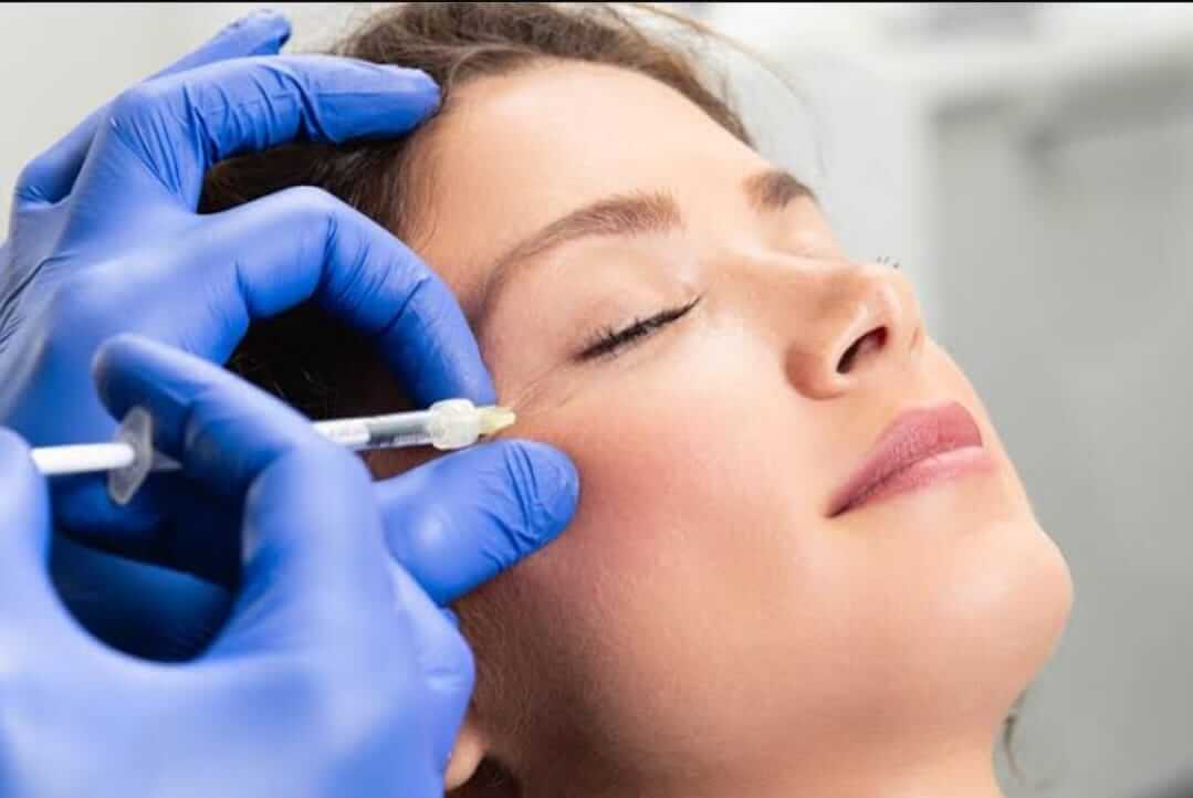 Benefícios do preenchimento com ácido hialurônico para a sua pele - Preenchimento Facial Goiânia