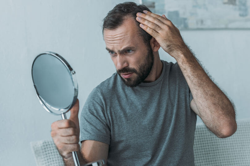 Quanto tempo demora para crescer cabelo depois do transplante capilar? - Cirurgião Plástico Maringá