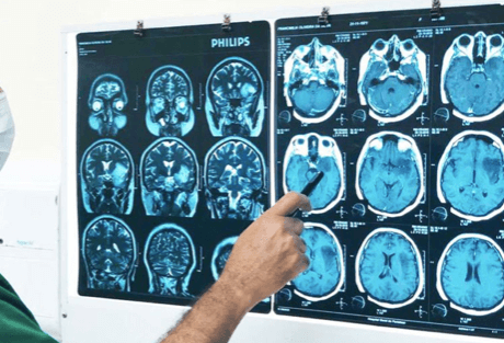 Cuidados com a Saúde Cerebral: Encontrando o Neurocirurgião Certo em Umuarama