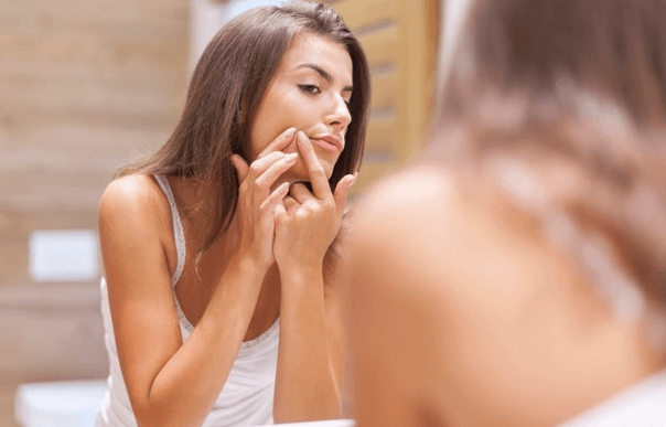  Acne Goiânia - Acne melhor tratamento.