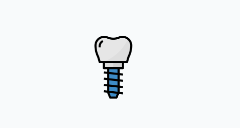 Quais as etapas de um implante dentário? Implante Dentário São Paulo