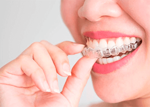 Ortodontia (aparelho Invisalign / Alinhadores/ aparelho fixo)