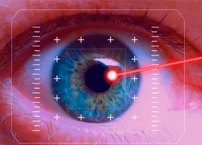 Cirurgia Refrativa