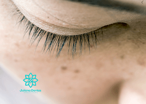 Tratamento de Melasma