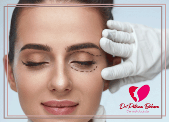 Blefaroplastia