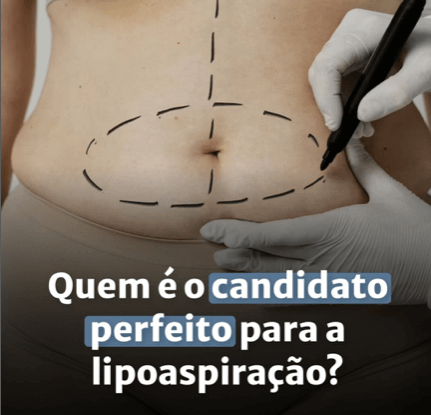 Será que você é a candidata