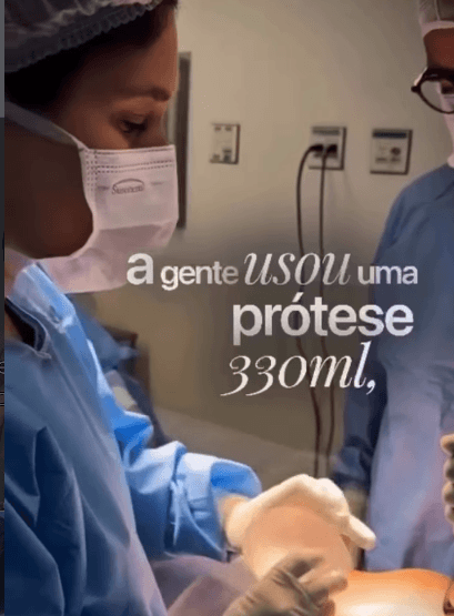 Melhorando o cortorno corpora
