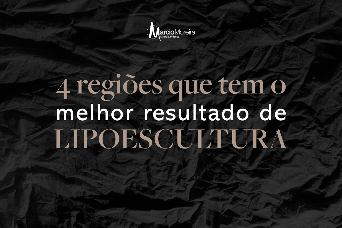 4 regiões que tem o melhor resultado de lipoescultura