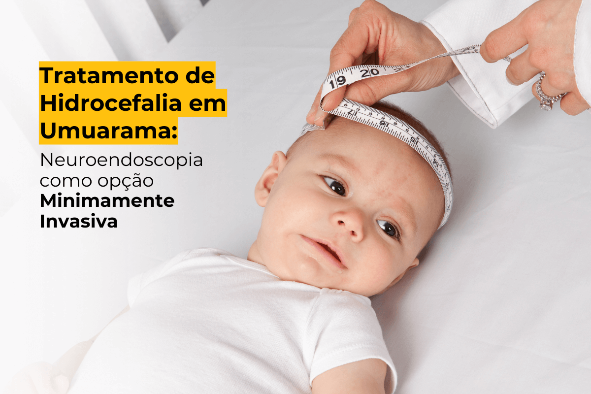 Tratamento de Hidrocefalia em Umuarama: Neuroendoscopia como Opção Minimamente Invasiva