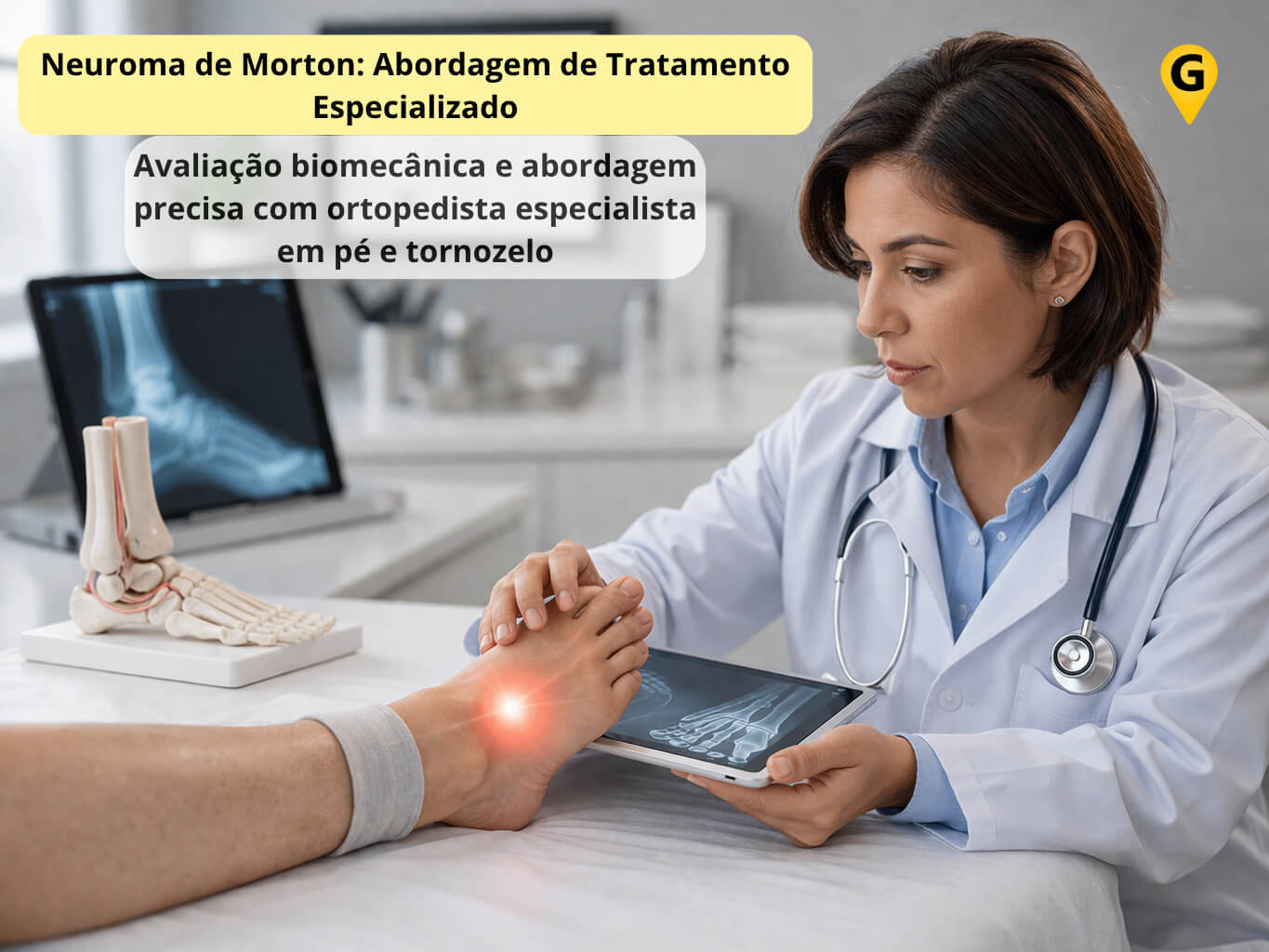 Neuroma de Morton: Tratamento Especializado em Curitiba