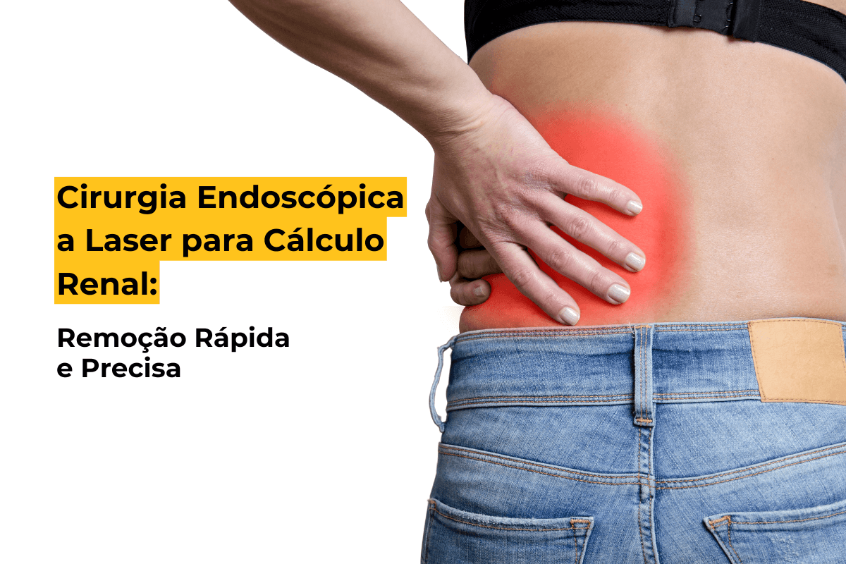 Cirurgia Endoscópica a Laser para Cálculo Renal em Maringá: Remoção Rápida e Precisa