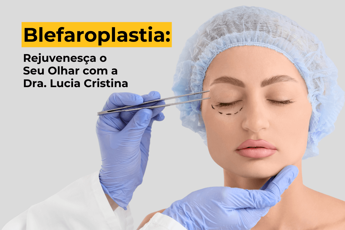 Blefaroplastia em Uberlândia: Rejuvenescimento para o Seu Olhar