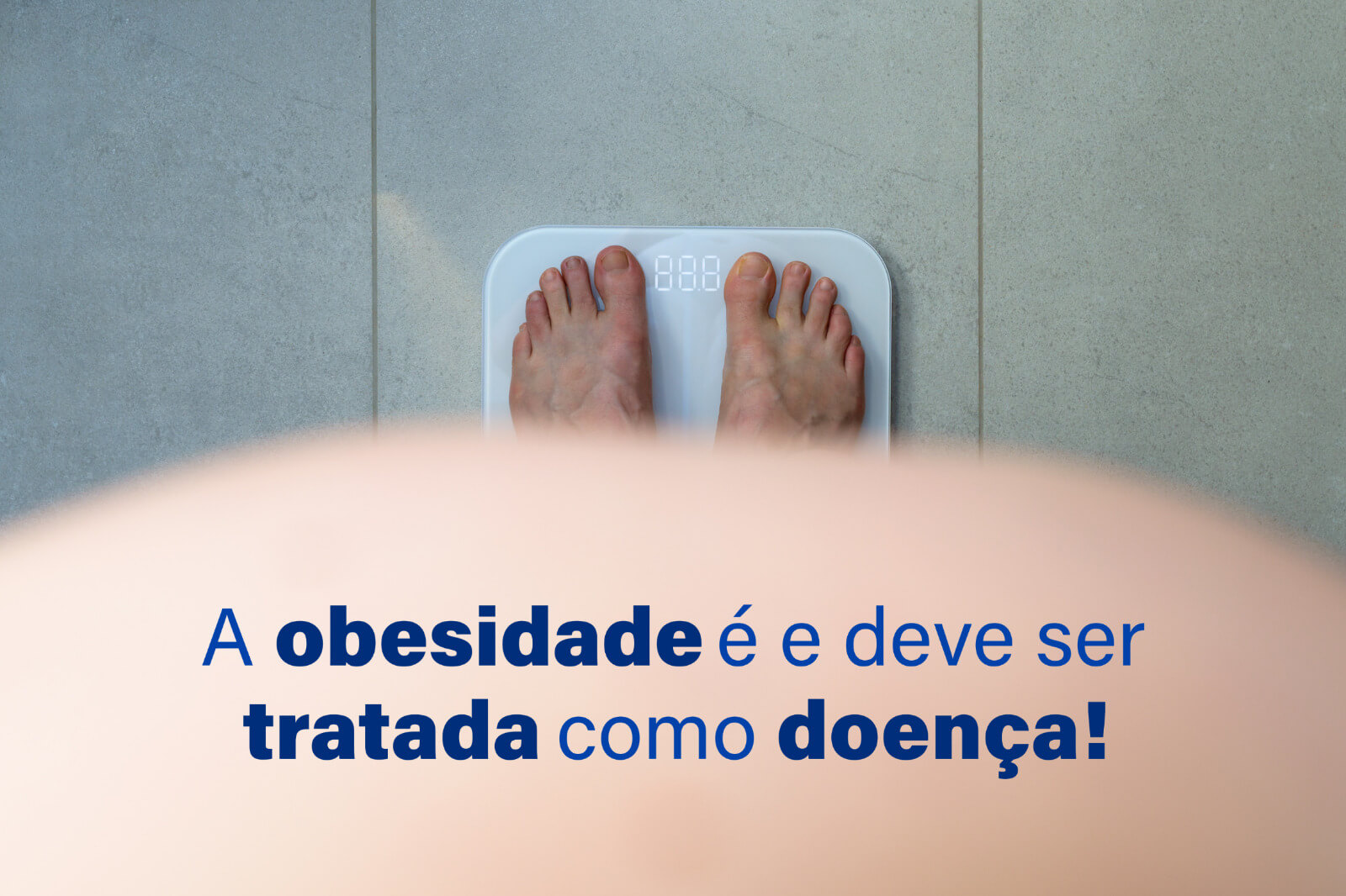 A obesidade é e deve ser tratada como doença!