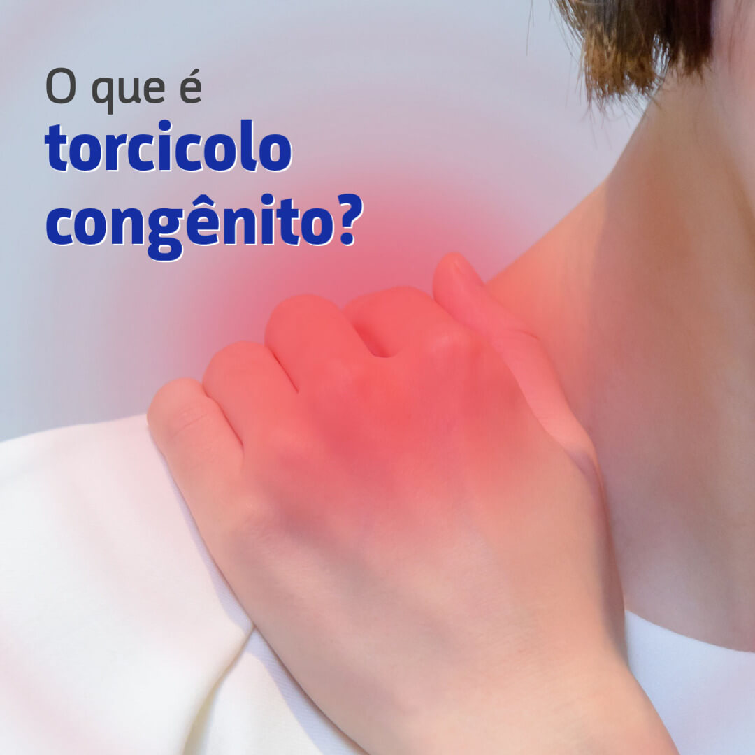 O que é torcicolo congênito?