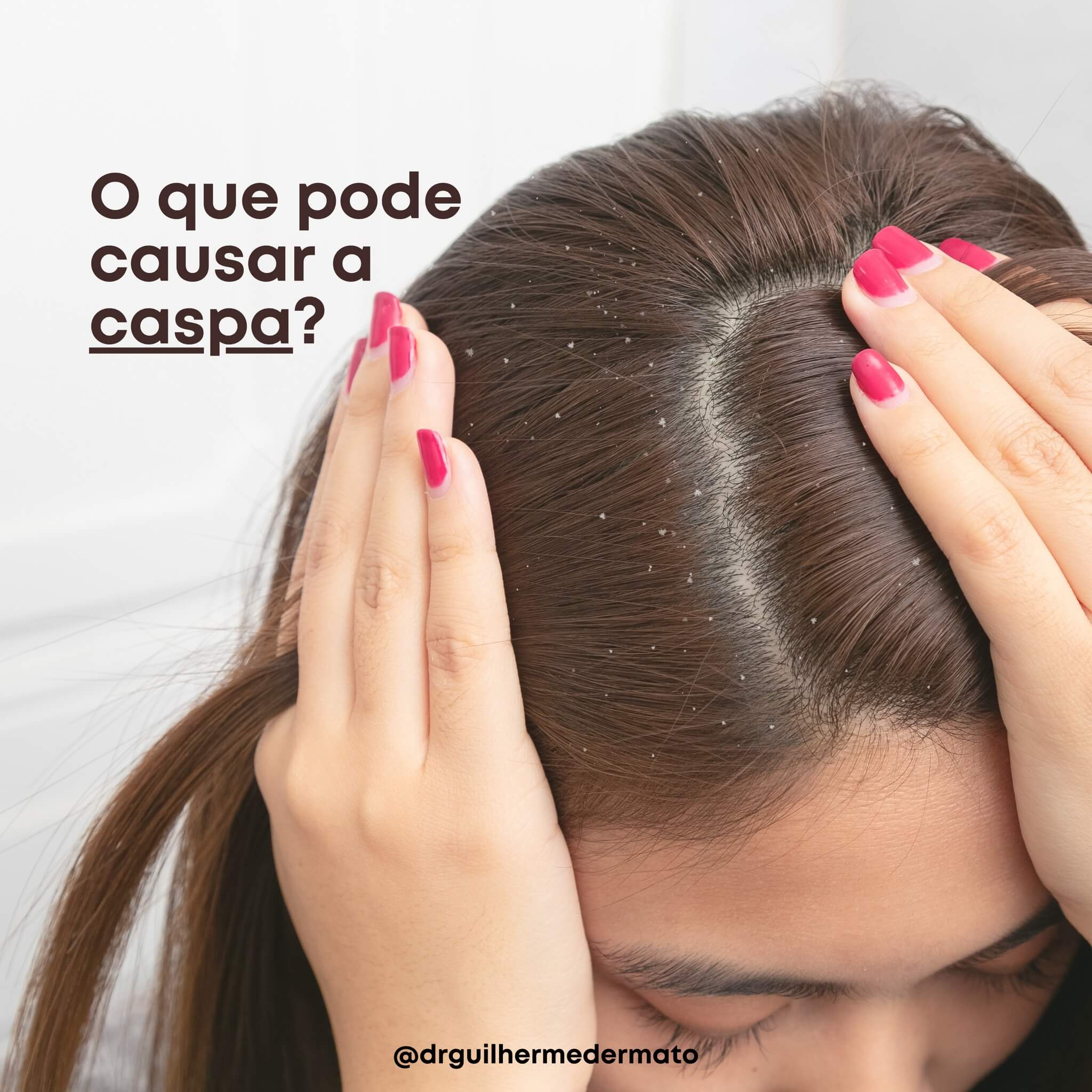 O que fazer para caspas?