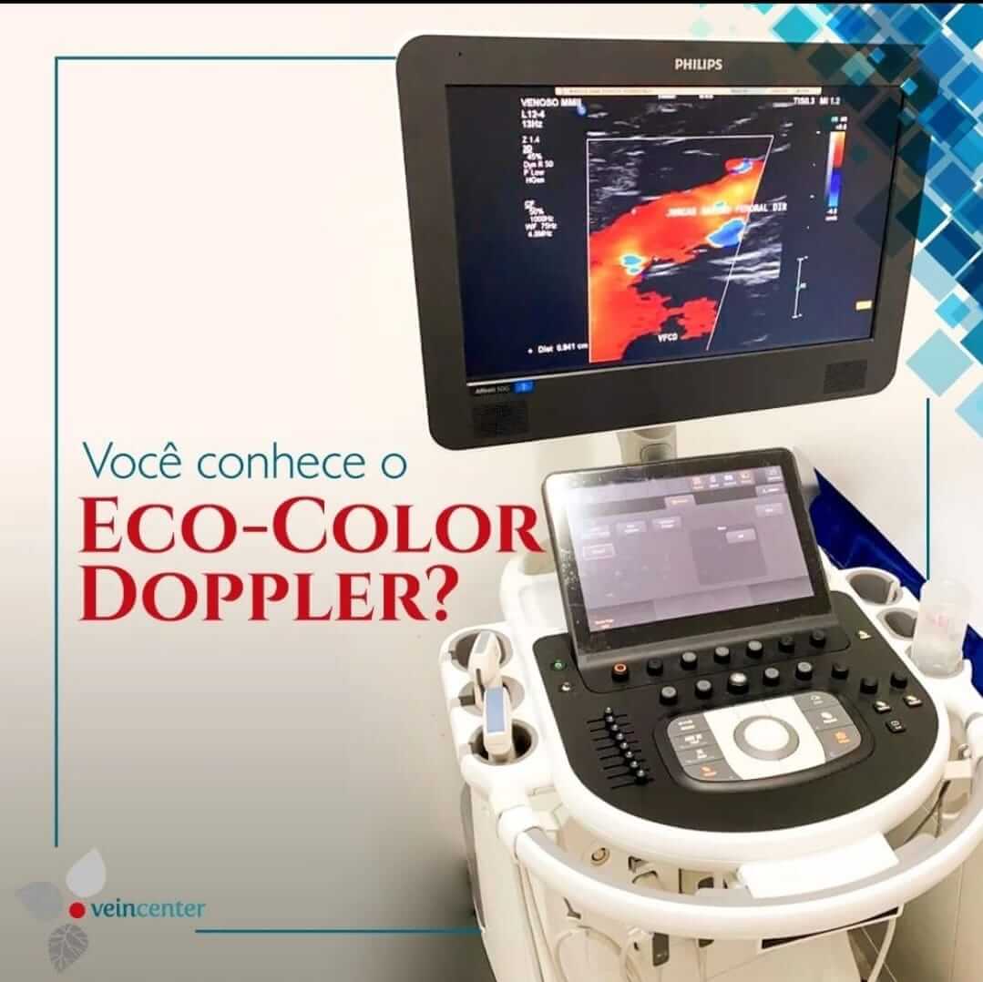 Você conhece o exame de Eco-Color Doppler?