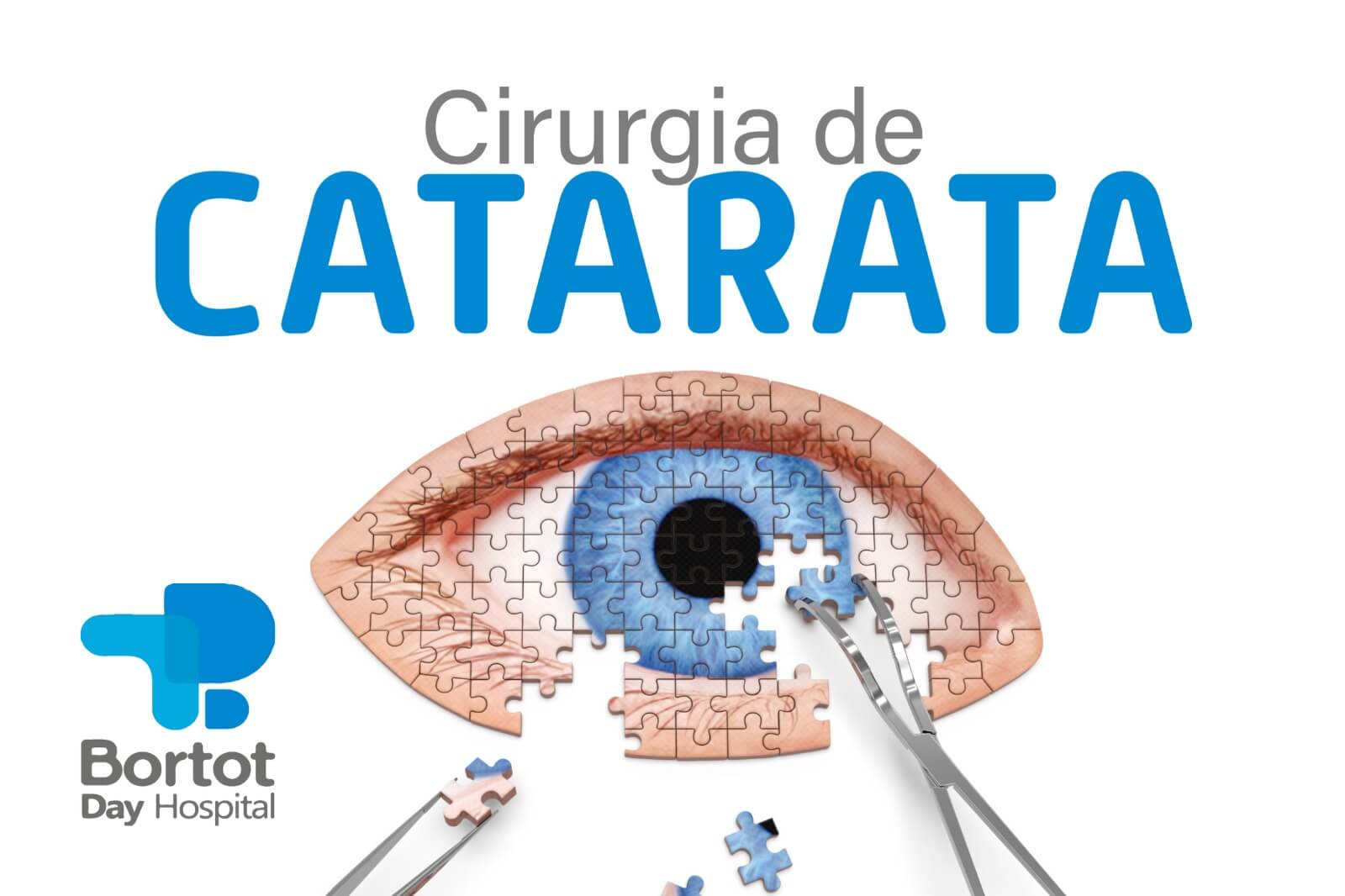 Cirurgia de Catarata 