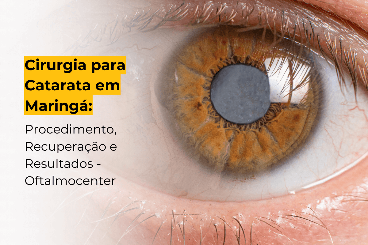 Cirurgia para Catarata em Maringá: Procedimento, Recuperação e Resultados - Oftalmocenter