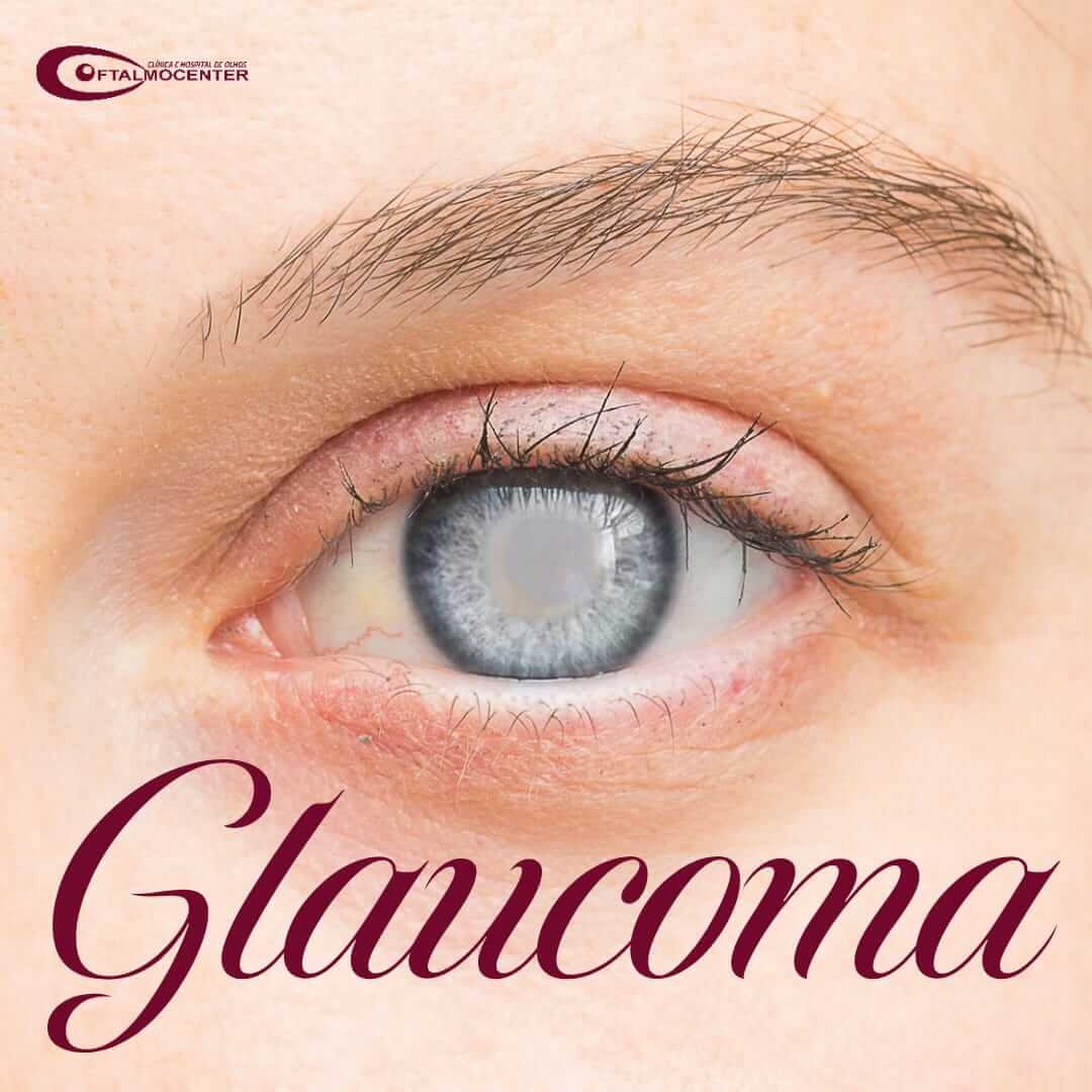 Glaucoma 