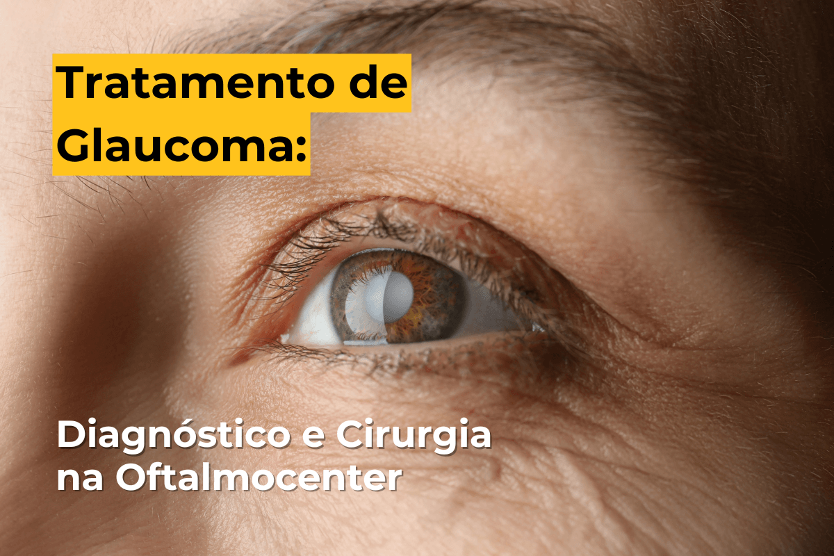  Tratamento de Glaucoma em Maringá: Diagnóstico e Cirurgia