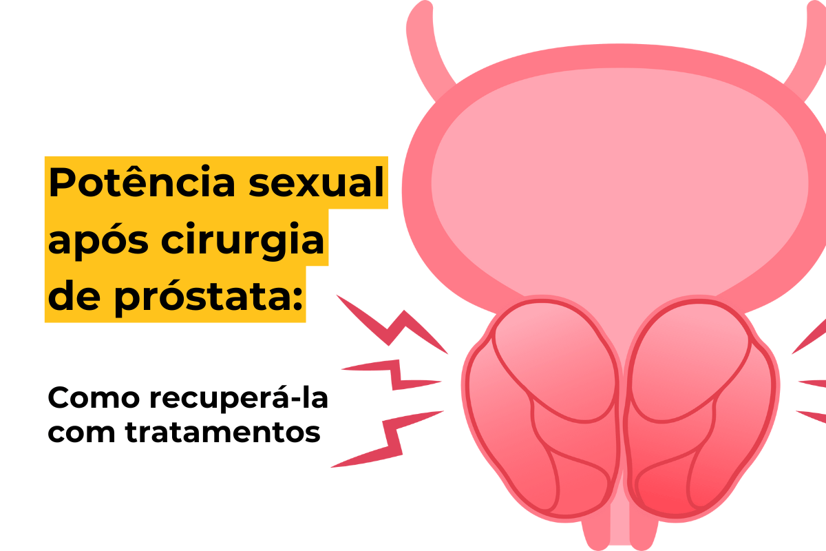 Potência Sexual Após Cirurgia de Próstata: Como Recuperá-la com Tratamentos em Maringá