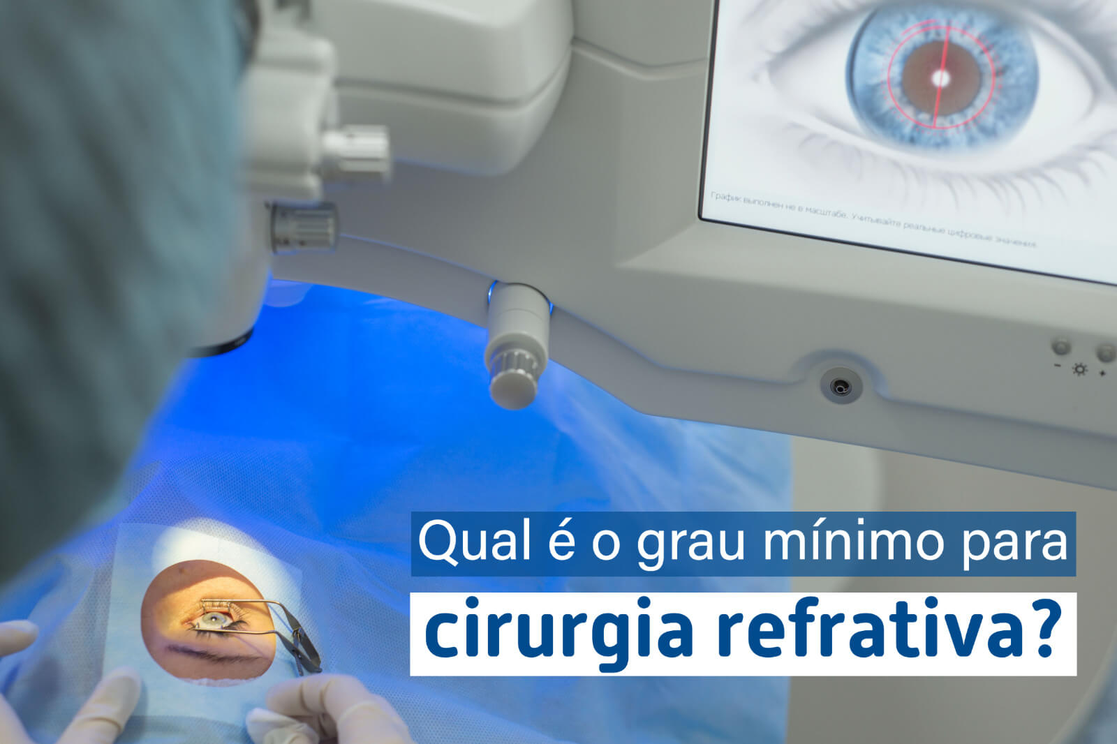 Qual é o grau mínimo para cirurgia refrativa?