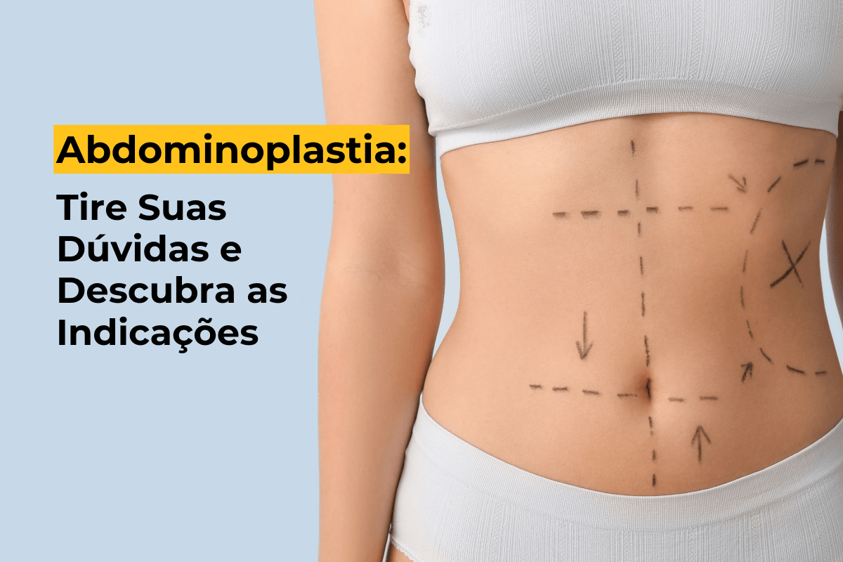 Abdominoplastia em Maringá: Tire Suas Dúvidas e Descubra as Indicações