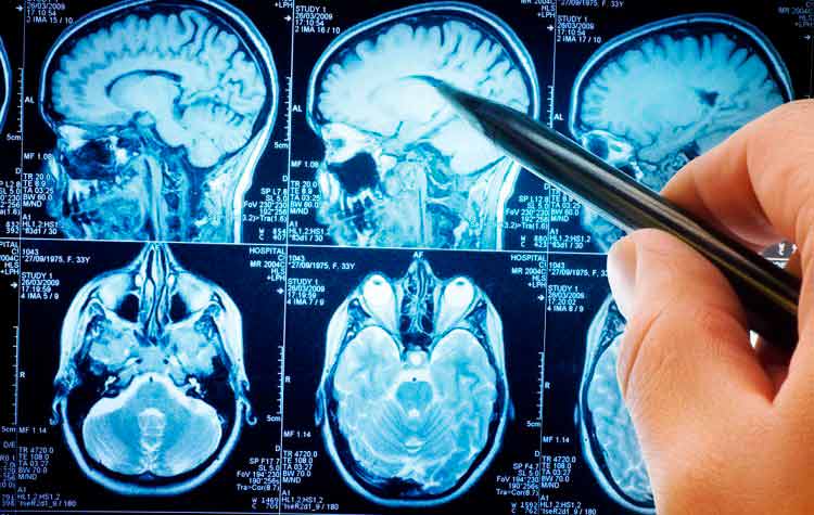 Microcirurgia do Sistema Nervoso em Umuarama: Avanços que Garantem maior Segurança