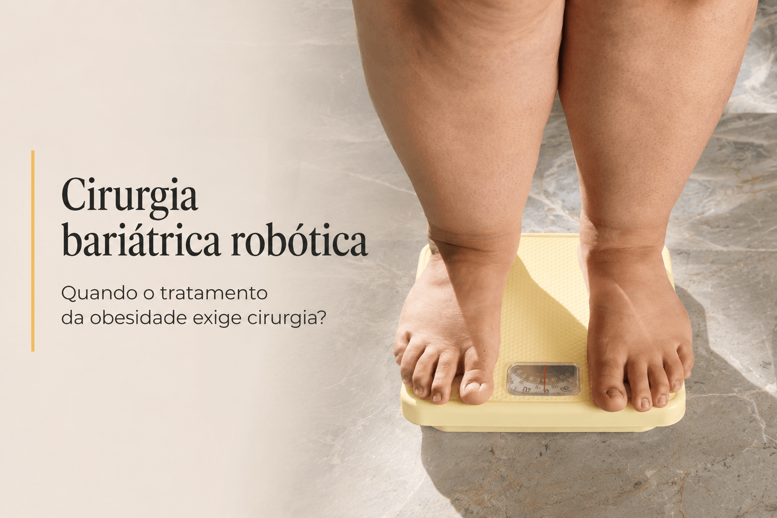 Cirurgia bariátrica robótica: quando o tratamento da obesidade exige cirurgia?