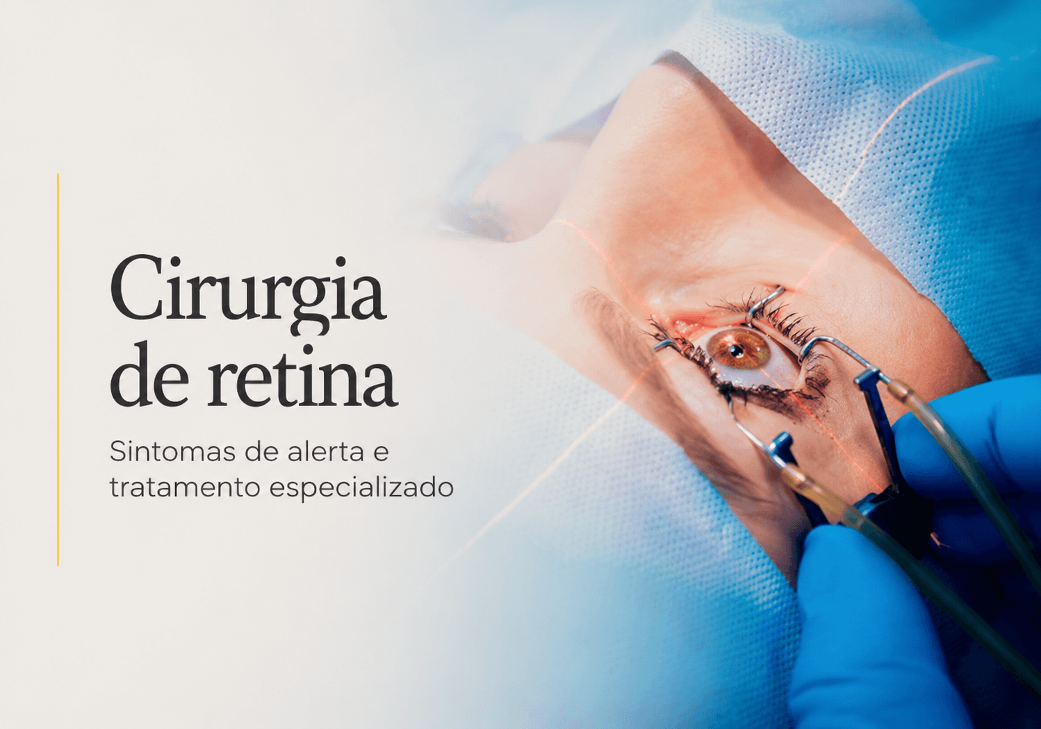 Cirurgia de retina em Maringá: sintomas de alerta e tratamento especializado