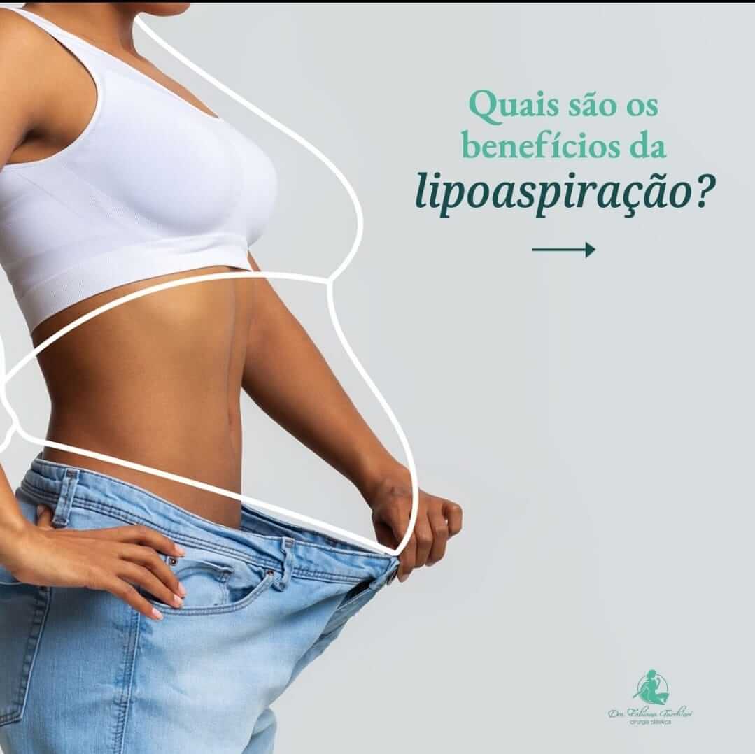 Quais são os benefícios da lipoaspiração?