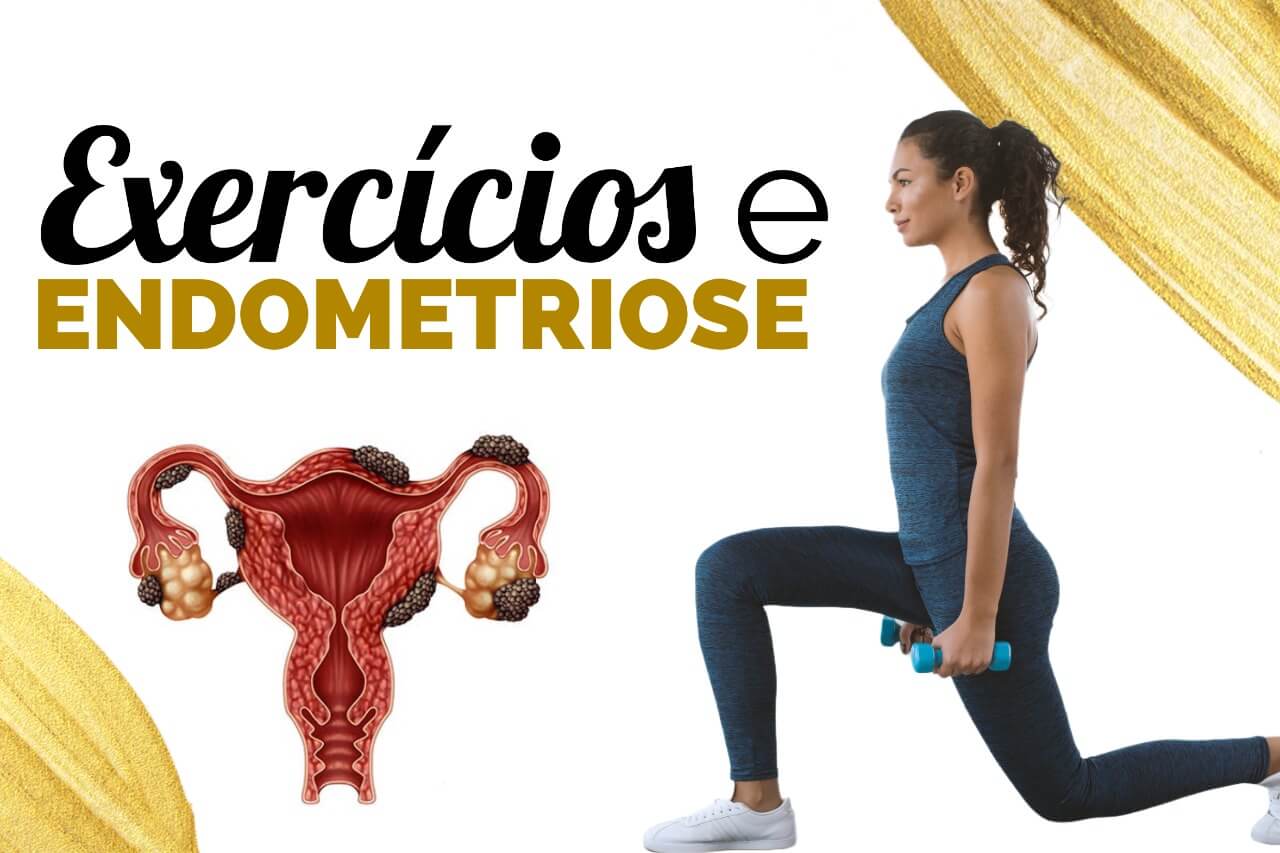 Exercícios e Endometriose