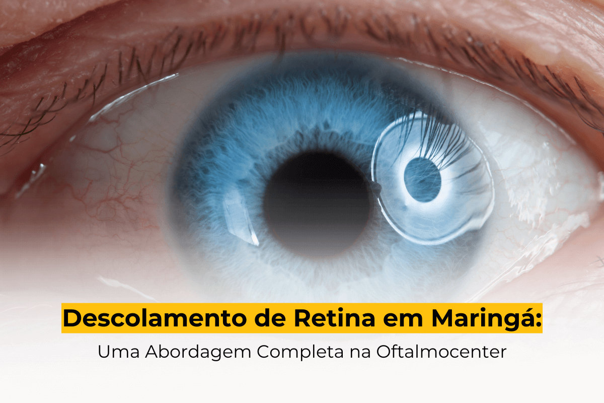 Descolamento de Retina em Maringá: Uma Abordagem Completa na Oftalmocenter