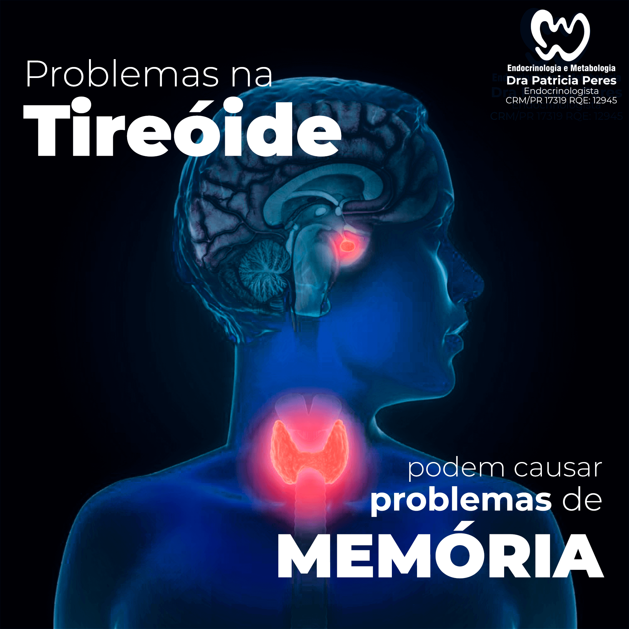 Problemas na tireoide podem causar problemas de memória