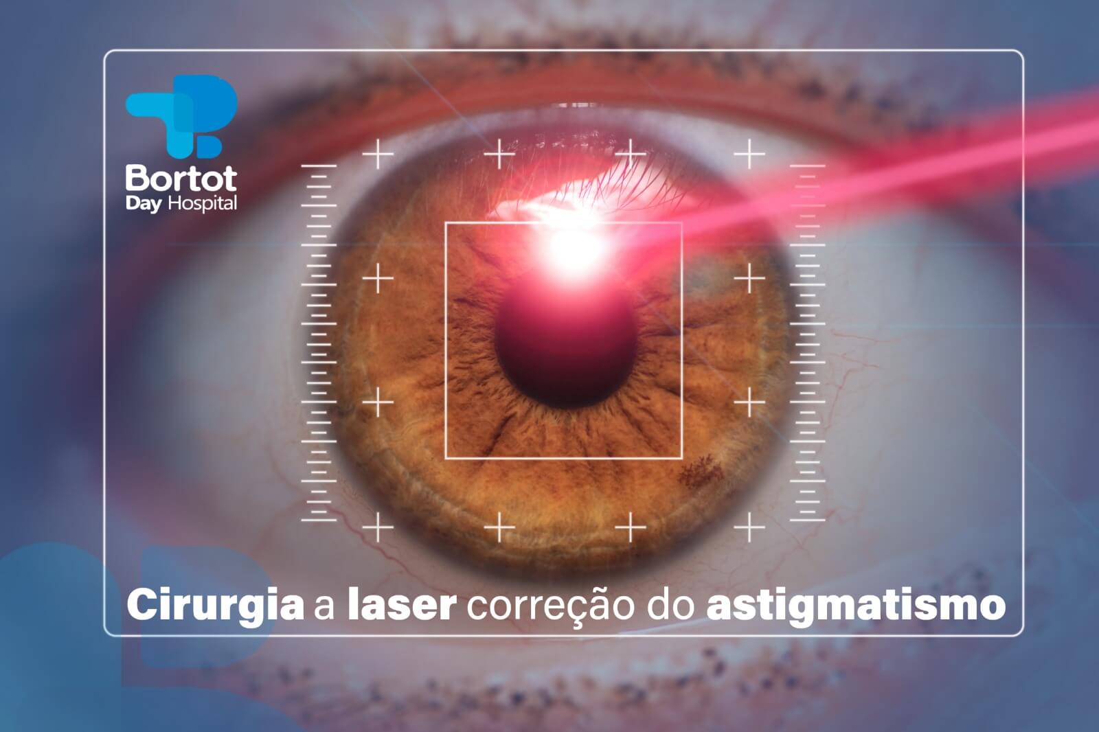 Cirurgia para correção do astigmatismo
